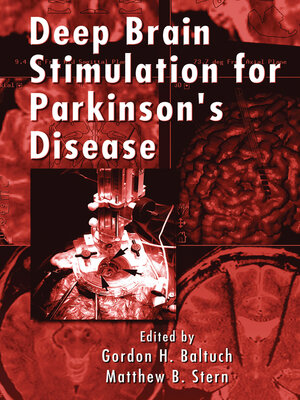 cover image of Deep Brain Stimulation for Parkinson's Disease